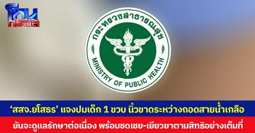 ‘สสจ.ยโสธร-รพ.สมเด็จพระยุพราชเลิงนกทา’ แจงปมเด็ก 1 ขวบ นิ้วขาดระหว่างถอดสายน้ำเกลือ ยืนยันจะดูแลรักษาต่อเนื่อง พร้อมชดเชย-เยียวยาตามสิทธิอย่างเต็มที่