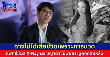 แพทย์ผู้เชี่ยวชาญ เผย “ผิง ชญาดา” อาจไม่ได้เสียชีวิตเพราะการนวด ผล X-Ray ไม่พบกระดูกกดสันหลัง