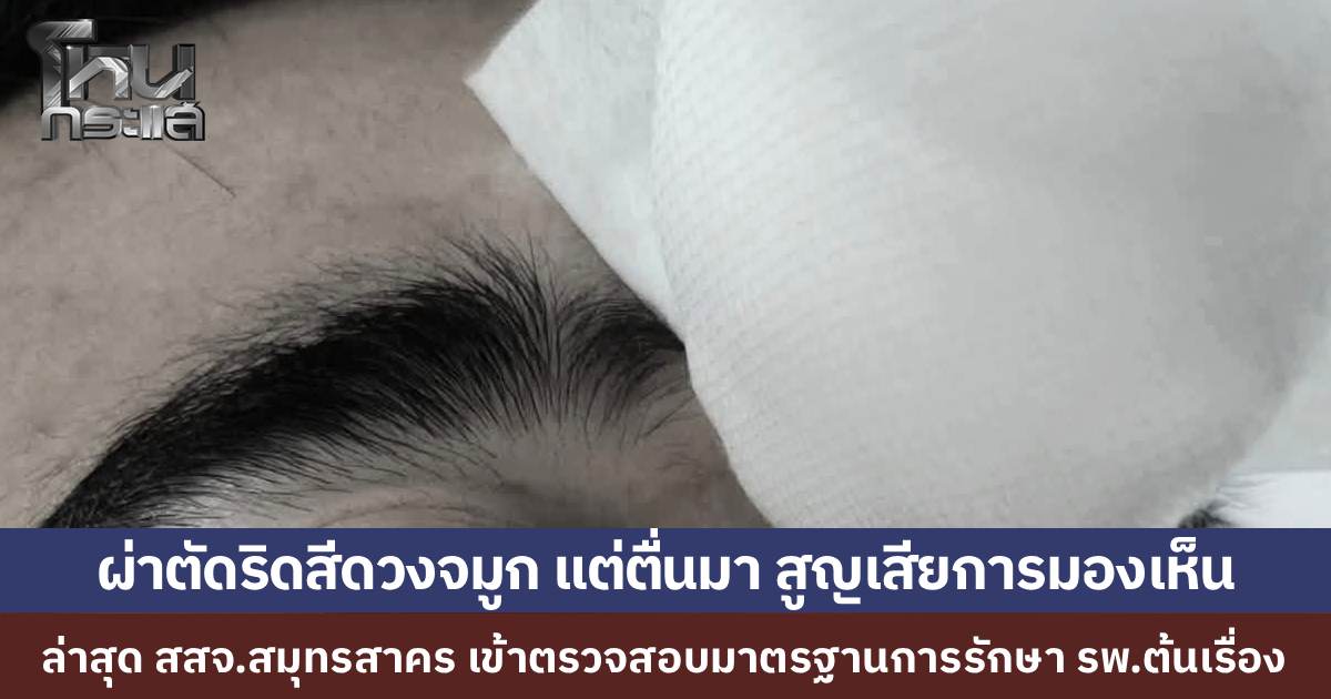 หนุ่มผ่าตัดริดสีดวงจมูกที่ รพ.เอกชน ตื่นมาสูญเสียการมองเห็น แฟนสาวร้องขอความเป็นธรรม พาไปตรวจ รพ.อื่น พบว่ากระทบเส้นประสาทตา สสจ.สมุทรสาคร ลุยสอบมาตรฐานการรักษา