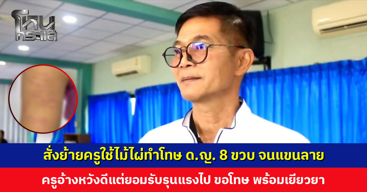 สั่งย้ายครูใช้ไม้ไผ่ทำโทษ ด.ญ. 8 ขวบ จนแขนลาย ครูอ้างหวังดี แต่ยอมรับลงโทษรุนแรงไป