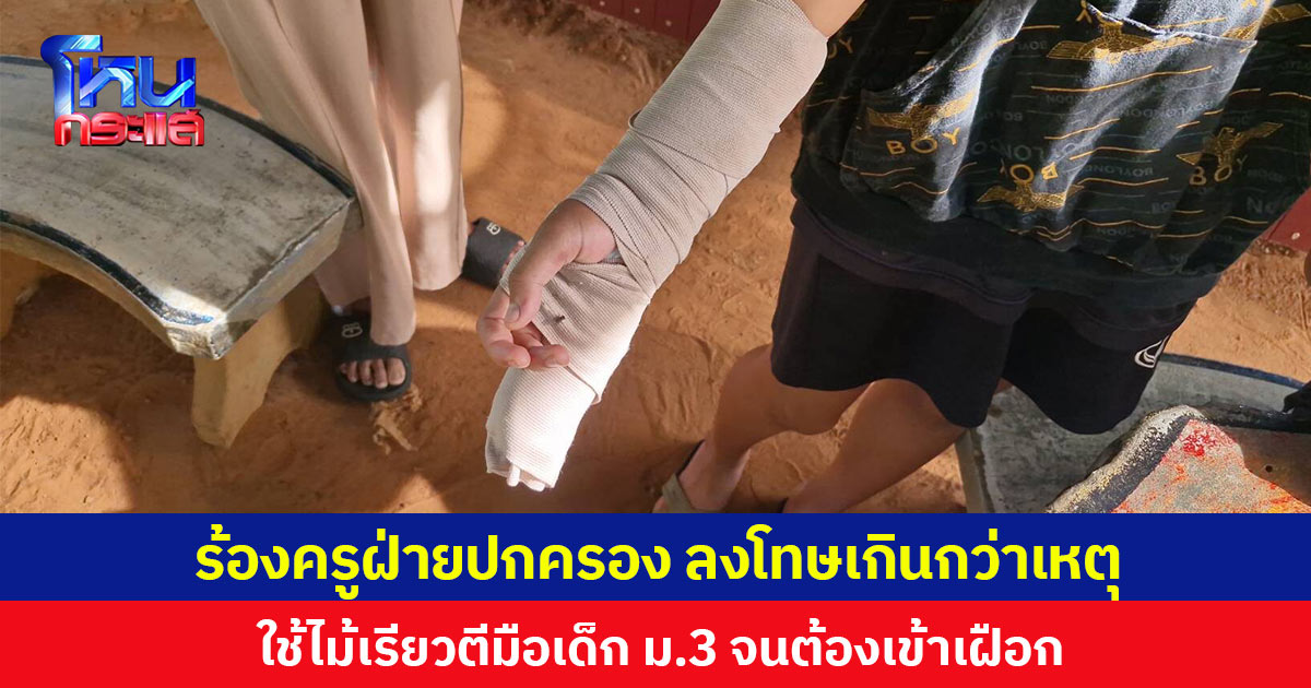 ผู้ปกครองไม่ทน ร้องครูปกครองลงโทษเกินกว่าเหตุ ใช้ไม้เรียวตีมือเด็ก ม.3 จนนิ้วแตกต้องใส่เฝือก
