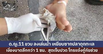 กู้ภัยรุดช่วย ด.ญ.11 ขวบ ลงเล่นน้ำ เหยียบซากปลาดุกทะเล เงี่ยงบาดลึกกว่า 1 ซม. สุดเจ็บปวด 