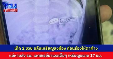 แม่โพสต์อุทาหรณ์ ลูกชายวัย 2 ขวบ เผลอกลืนเหรียญลงท้อง รีบช่วยตบหลัง ก่อนนำส่งโรงพยาบาล เอกซเรย์เจอเต็มๆ หมอให้กลับบ้านรอดูอาการ