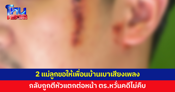 เพื่อนบ้านเปิดเพลงดังกลางดึก สองแม่ลูกขอให้เบาเสียง กลับถูกตีหัวแตกต่อหน้า ตร.