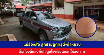 แม่ร้องสื่อ ลูกชายถูกครูตีจนเป็นรอยช้ำ ซ้ำด่าด้วยคำหยาบคาย