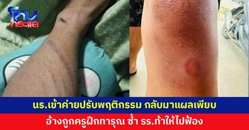 ลูกสาวเข้าค่ายปรับพฤติกรรม กลับมาแผลเต็มตัว อ้างถูกครูฝึกทารุณ 