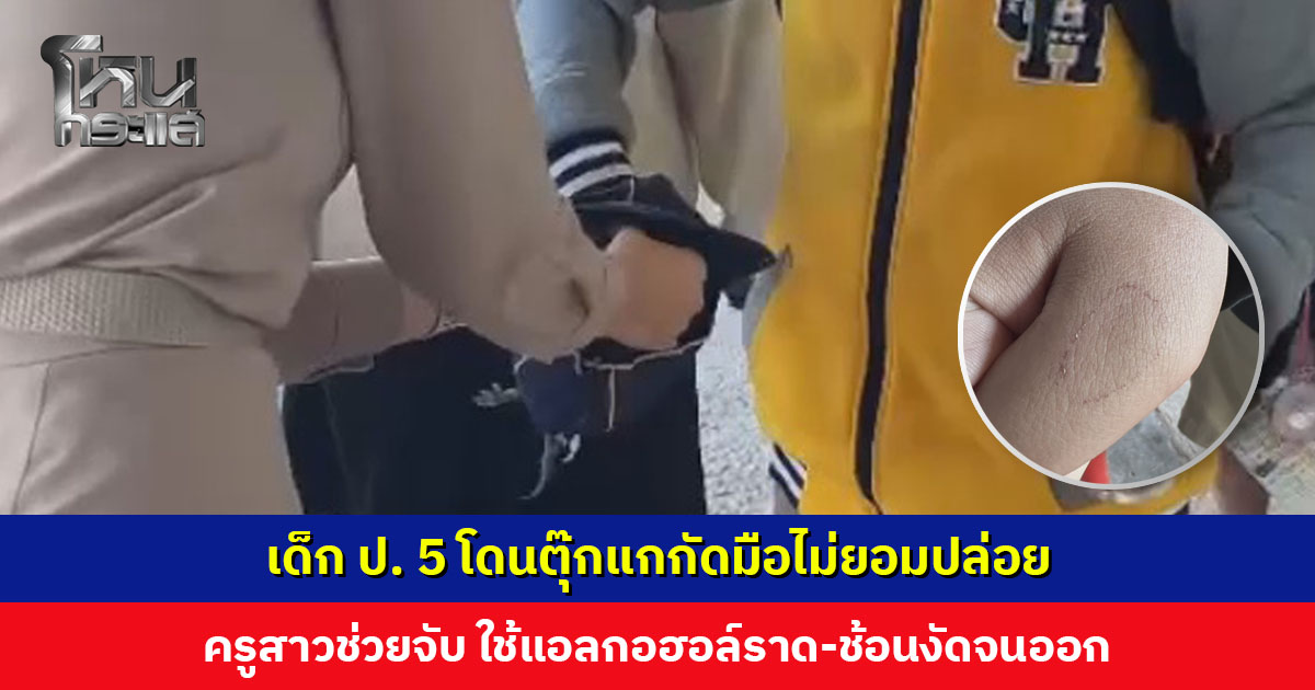 เด็ก ป. 5 โดนตุ๊กแกกัดมือไม่ยอมปล่อย ครูสาวช่วยจับ ใช้แอลกอฮอล์ราด-ช้อนงัดจนออก