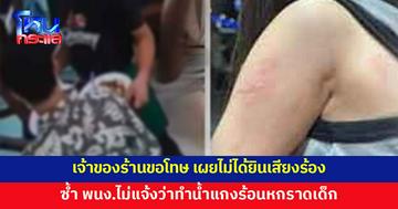 เจ้าของร้านขอโทษ ไม่ได้ยินเสียงร้อง ซ้ำพนักงานไม่แจ้ง จึงไม่รู้ว่าน้ำแกงร้อนหกราดแขนเด็ก