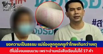 ขอความเป็นธรรม แม่ร้องลูกถูกครูทำโทษเกินกว่าเหตุ ตีไม่ยั้งจนแขนบวม เพราะอ่านหนังสือเรียนไม่ได้ 17 คำ