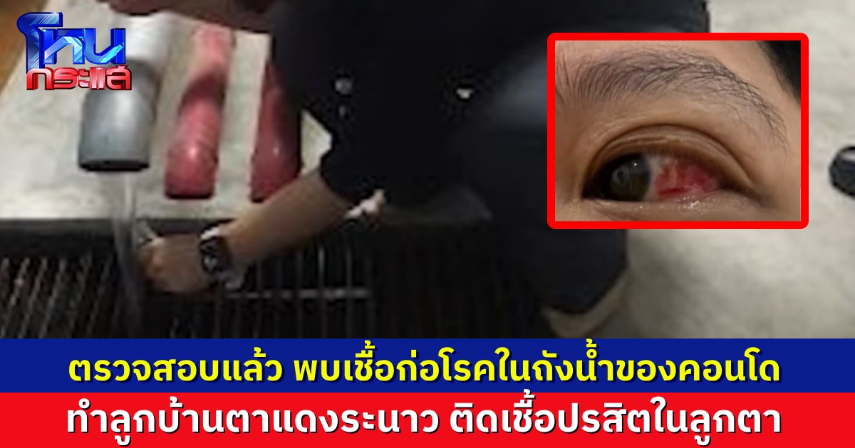 ประปาตรวจสอบแล้ว เชื้อโรคอยู่ที่ถังน้ำของคอนโด ทำลูกบ้านตาแดง ติดเชื้อปรสิตในลูกตา