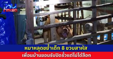 เพื่อนบ้านปิดรั้วแต่ไม่ได้ล็อก หมาหลุด ขย้ำเด็ก 8 ขวบ เจ็บสาหัส 