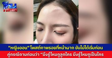 “หญิงออน ดวงพร” โพสต์ภาพรอยบาดเจ็บบนใบหน้า ปมวิวาทกลุ่ม “โมนา” สาว LGBTQ+ ลั่นแจ้งความดำเนินคดีถึงที่สุด เหตุถูกด่า-ป่วนก่อน