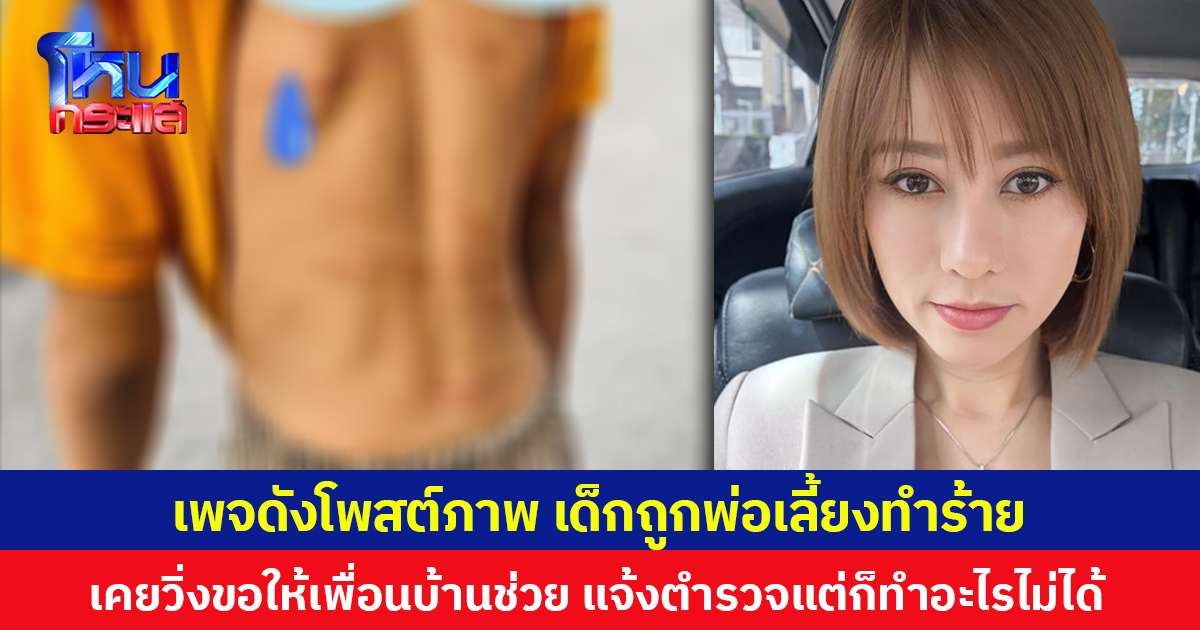 เพจดังโพสต์ภาพ เด็กถูกพ่อเลี้ยงทำร้าย  เคยวิ่งขอให้เพื่อนบ้านช่วย แจ้งตำรวจแต่ก็ทำอะไรไม่ได้