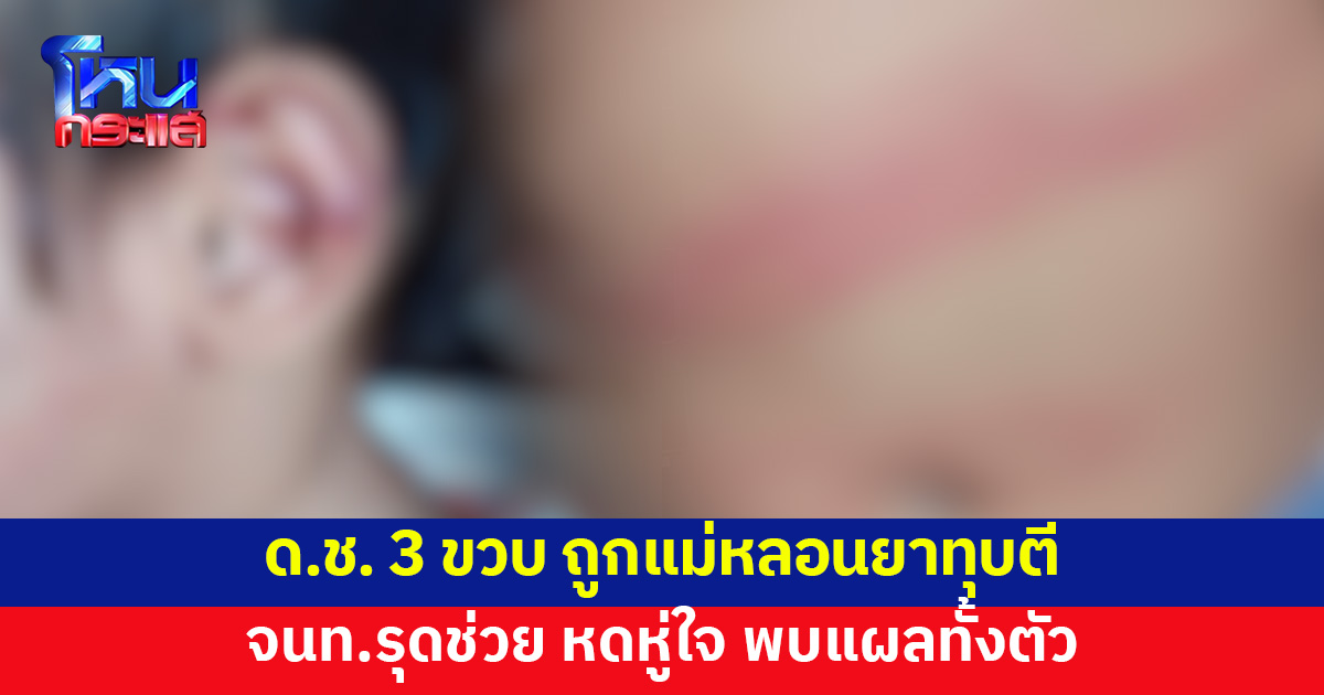 หดหู่ใจ ด.ช. 3 ขวบ อยู่กับพ่อแม่ทาสยา ถูกแม่ทุบตีประจำ จนท.รุดช่วย พบแผลทั่วตัว
