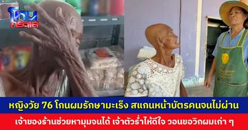 หญิงวัย 76 ปี สแกนหน้าบัตรคนจนไม่ผ่าน เพราะโกนผมรักษามะเร็ง วอนขอวิกผมเก่า ๆ จากผู้ใจบุญ