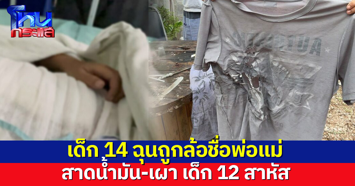 เด็ก 14 ฉุนถูกล้อชื่อพ่อแม่ สาดน้ำมัน-เผา เด็ก 12 สาหัส สำนึกผิดขอโทษ พ่อโร่แจ้งความ
