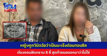 หญิงถูกวินิจฉัยว่าเป็นมะเร็งต่อมทอนซิล ต้องถอนฟันกราม 8 ซี่ สุดท้าย รพ. แห่งที่สองยืนยันว่าไม่พบเชื้อมะเร็ง