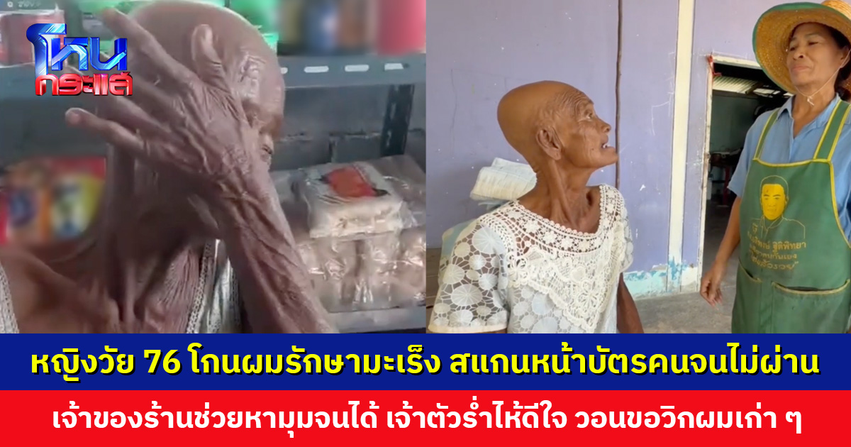 หญิงวัย 76 ปี สแกนหน้าบัตรคนจนไม่ผ่าน เพราะโกนผมรักษามะเร็ง วอนขอวิกผมเก่า ๆ จากผู้ใจบุญ