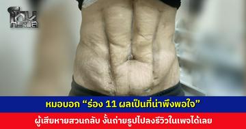หมอบอก “ร่อง 11 ผลเป็นที่น่าพึงพอใจ” ผู้เสียหายสวนกลับ บอกให้ถ่ายภาพแล้วเอาไปลงรีวิวได้เลย