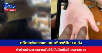 อดีตแฟนสาวแฉ หนุ่มเกียรตินิยม ม.ดัง ทำร้ายร่างกายสารพัดวิธี ต้องหยุดเรียน รักษาแพนิค-ซึมเศร้า เผยมีเหยื่ออีกหลายราย