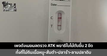 เพจดังเผยผลตรวจ ATK พยาธิใบไม้ตับขึ้น 2 ขีด ทั้งที่ไม่กินเนื้อหมู-ปลาร้า-ปลาดิบ