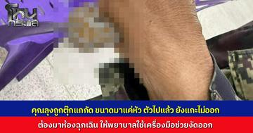 ลุงรุดเข้าห้องฉุกเฉิน "ตุ๊กแก" กัดมือไม่ปล่อย แม้หัวขาดแล้ว แต่แกะยังไงก็ไม่ออก พยาบาลต้องใช้เครื่องมืองัดช่วย