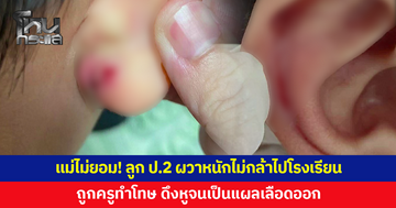 แม่ไม่ยอม! ลูกชาย ป.2 ผวาหนักไม่กล้าไปโรงเรียน หลังถูกครูทำโทษ ดึงหูจนเลือดออก