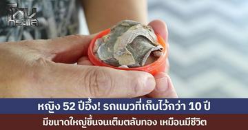 หญิง 52 ปีอึ้ง! รกแมวที่เก็บไว้กว่า 10 ปี มีขนาดใหญ่ขึ้นจนเต็มตลับทอง เหมือนมีชีวิต