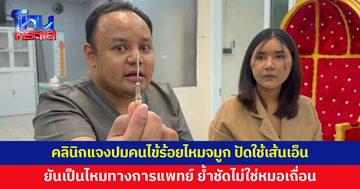 คลินิกเสริมความงามแจงปมคนไข้ร้อยไหมจมูกแล้วอักเสบ ปัดใช้เส้นเอ็น ยันเป็นไหมทางการแพทย์